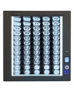 Wolf X-Ray 26001 LED Trimline Illuminator Single Bank - 14 x 17